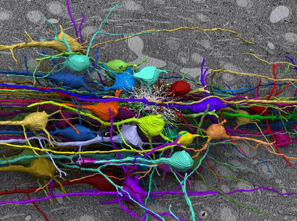 3D reconstruction of neurons | 출처: ZEISS Microscopy