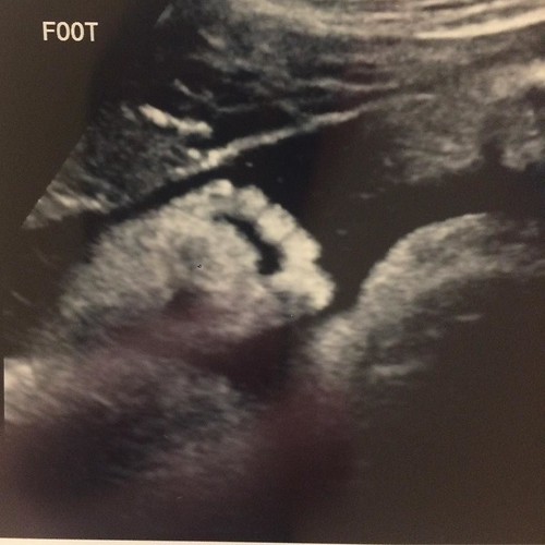 Probably my last ultrasound before the little dude is born. I'm already obsessed with his feet! 😍