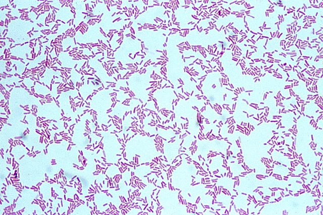Pseudomonas aeruginosa Gram Stain | microbekeeper | Flickr