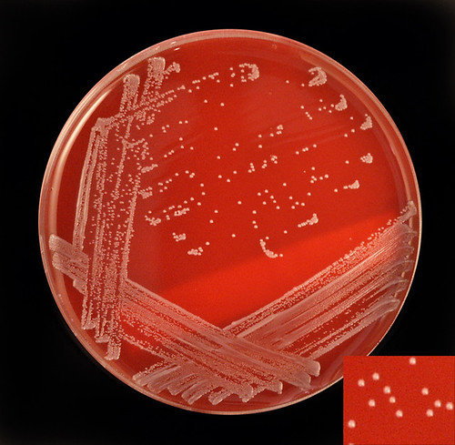 Escherichia coli (E coli) Infections