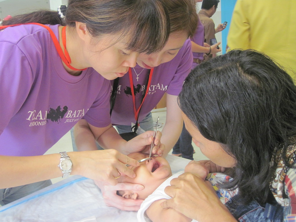 Serious work: Senior staff nurse Florence Ng Xxxxxxxx with a cleft lip patient at the Rumah Sakit Awal Bros Hospital during her mission trip to Batam, Indonesia, in July 2011.