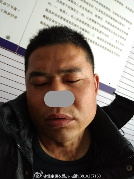 Beijing announced anti-PA police thieves pictures, mosaics on the suspect's nose