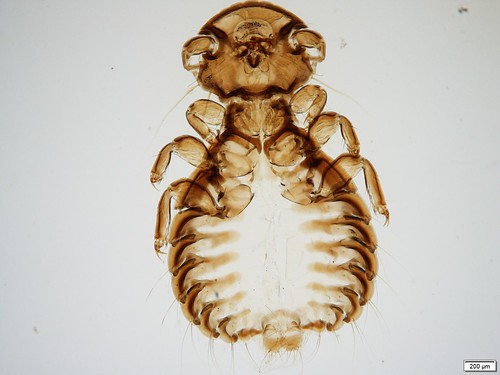 Microscopic image of Goniodes leucurus. 