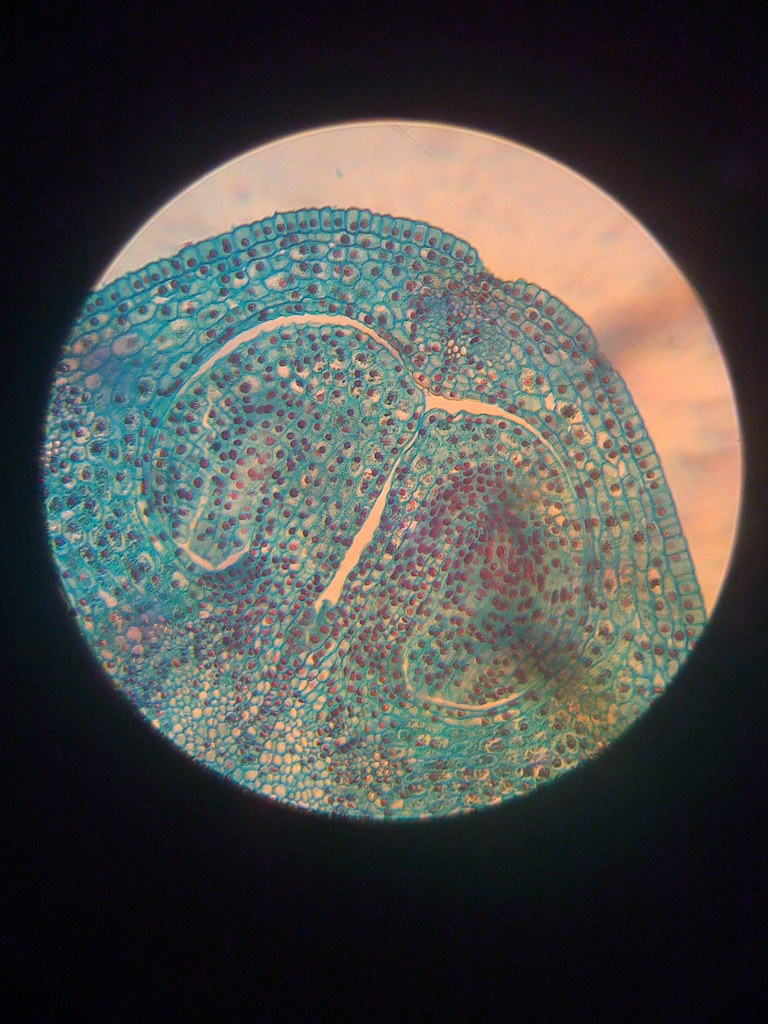 Mature Embryo 12