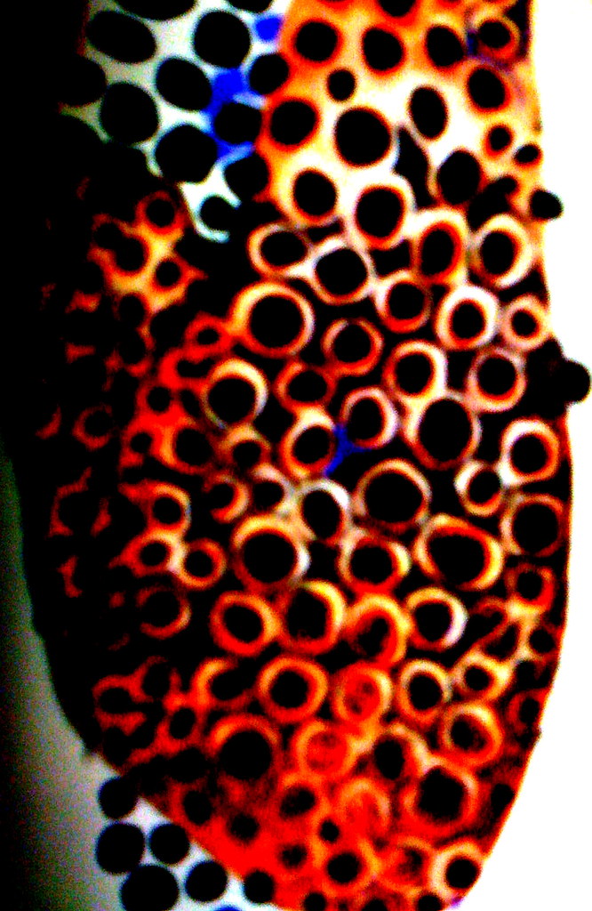 Trypophobia - Fear of Holes | Fear of holes, clusters, bumps… | Flickr