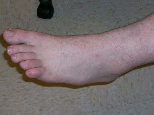See The Lump On The Side Of His Foot That S Bone Tamara Flickr