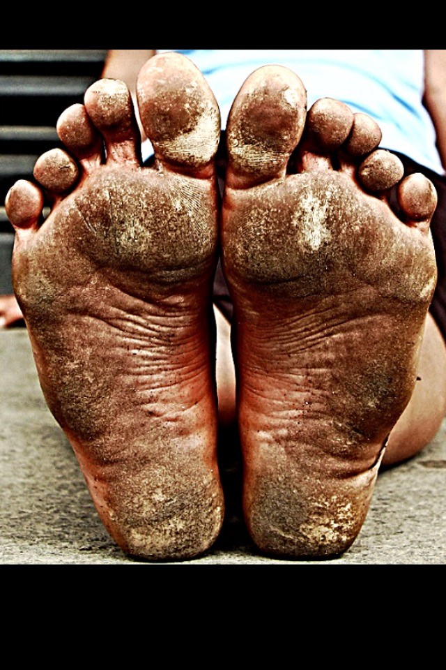 tough-callous-dirty-feet-just-go-barefoot-flickr