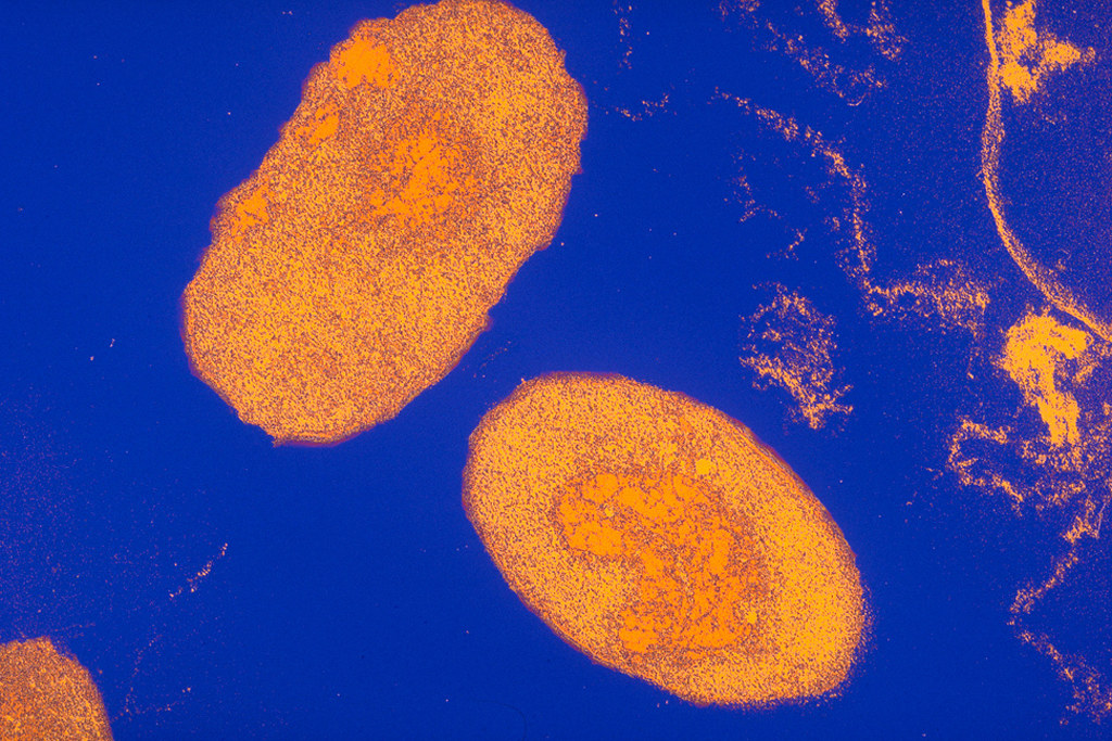 Pertussis bacteria (Bordetella pertussis)  Electron microsc…  Flickr