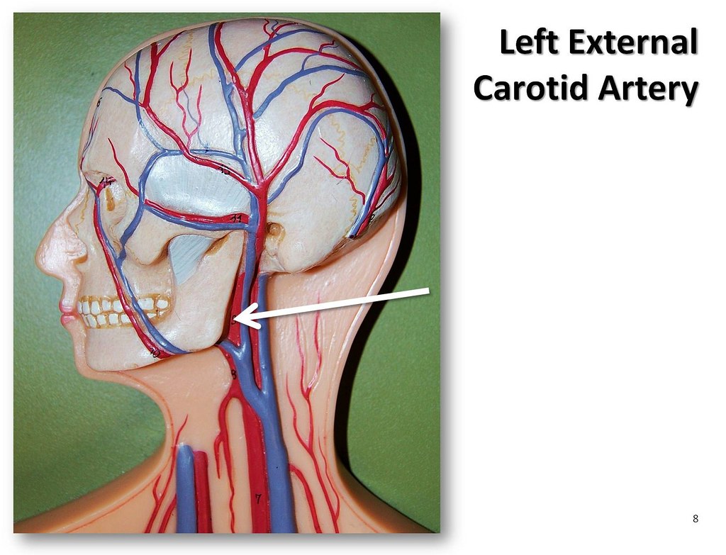 Common Carotid Artery Carotid Sinus And Carotid Body - vrogue.co