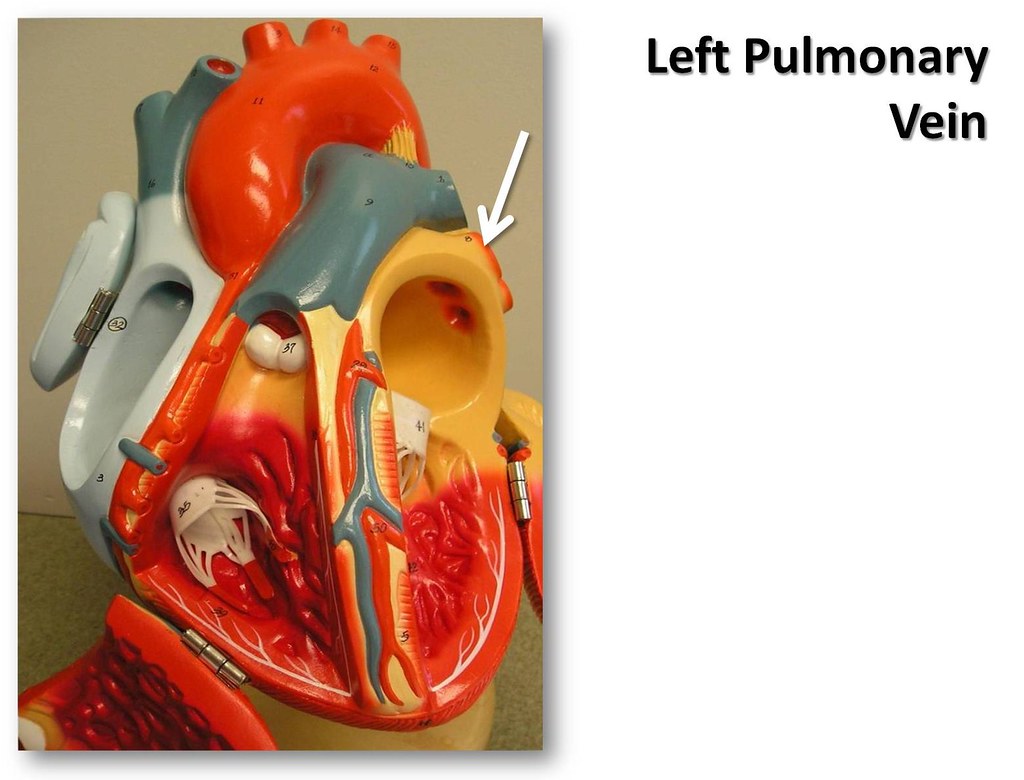 Left pulmonary vein, anterior view The Anatomy of the He… Flickr
