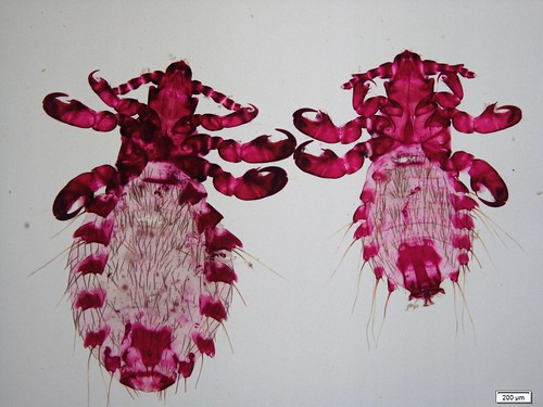 Microscopic image of two lice. 