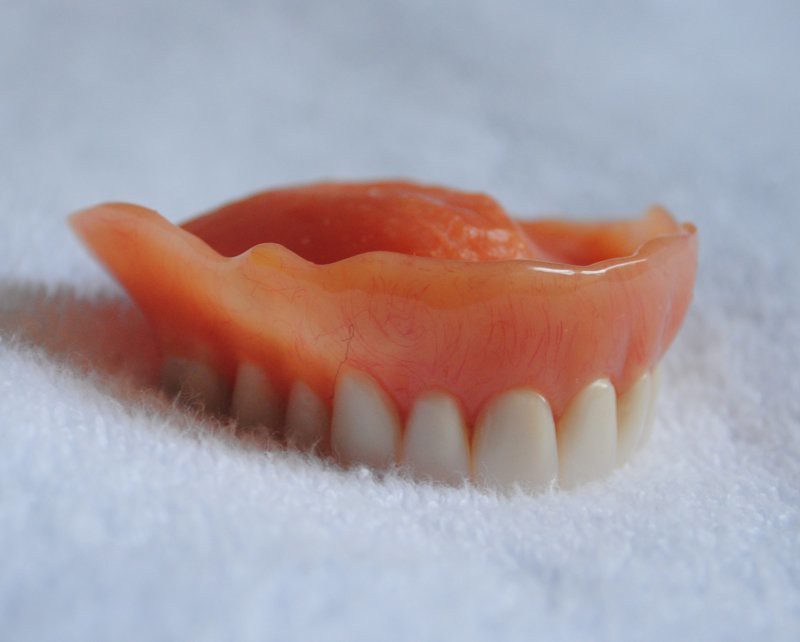 Dental Implants or Dentures