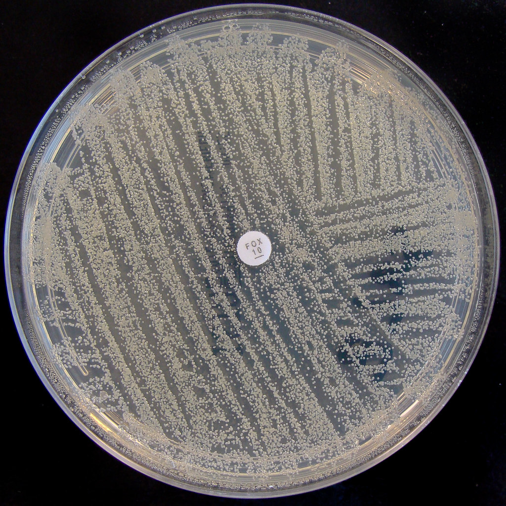 Staphylococcus aureus (M.R.S.A.) - Methicillin\/Meticillin ...