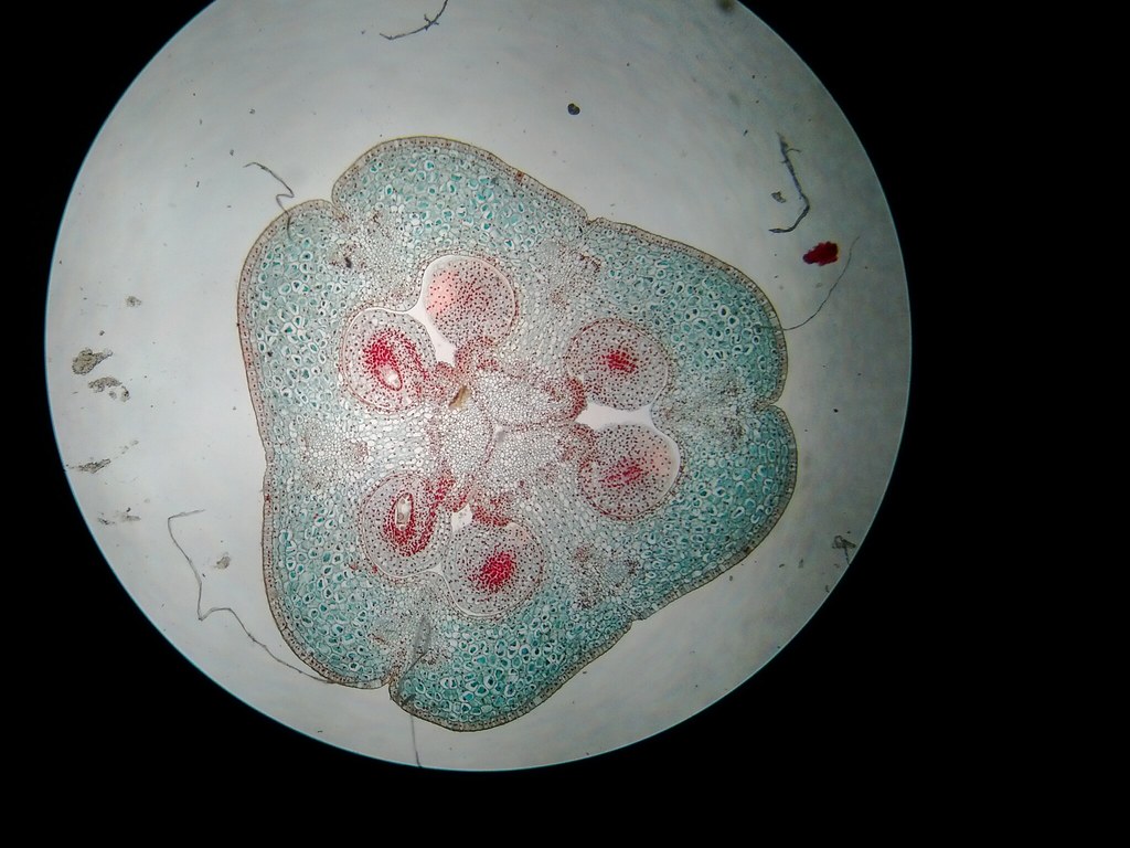 Mature Embryo 17