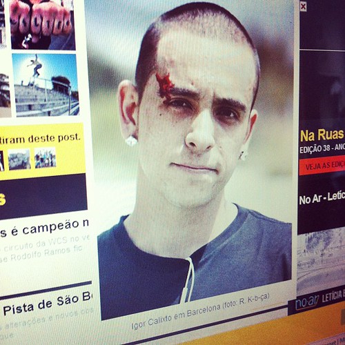 Igor Calixto dando sangue em Barcelola CMYK digital com Rodrigo K-B-ÇA no site da revista 100% skate www.cemporcentoskate.com.br - 7020690369_b023d1d3e4