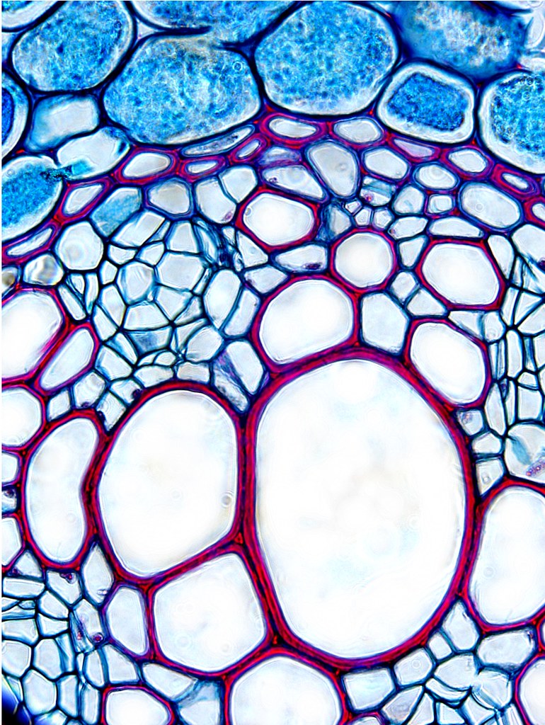 Transverse Section Another Name