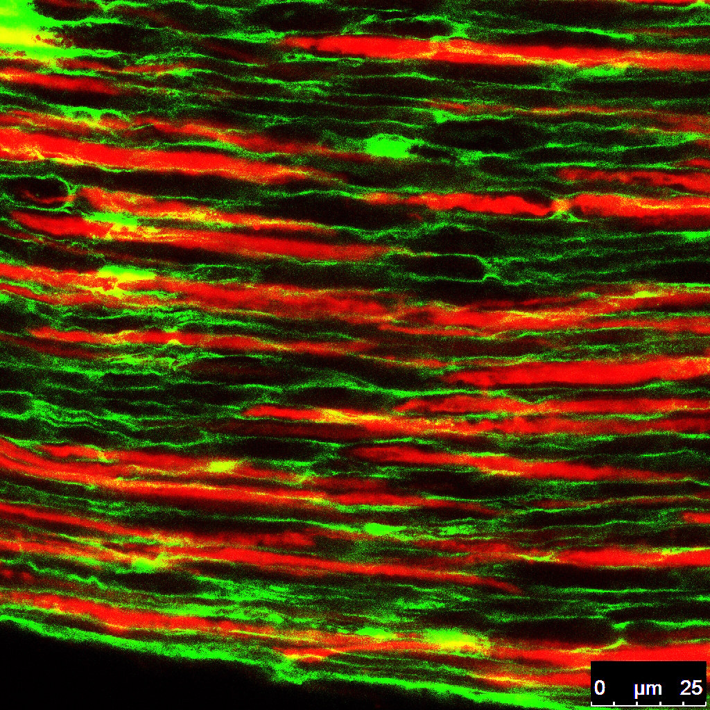 Sensory nerve of the mouse incisor | Sensory nerve marker CG\u2026 | Flickr