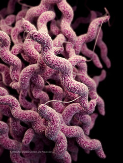 彎曲桿菌Campylobacter。圖片來源：美國疾病預防管制中心 CDC