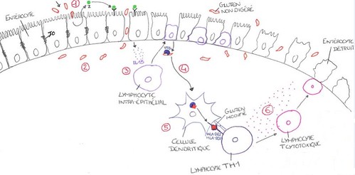 mécanismes moléculaires de la maladie coeliaque